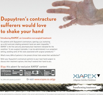 3 benefits of Augmented Reality in healthcare Dupuytrens3